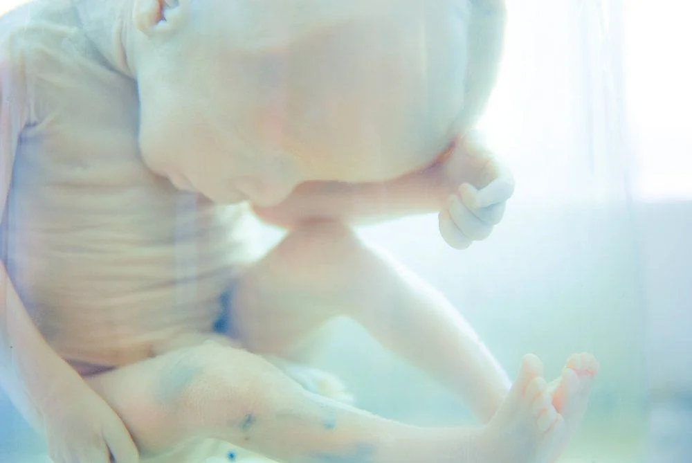 UNFPA preokupa bebé 18 mate iha sentru saúde Liquiça