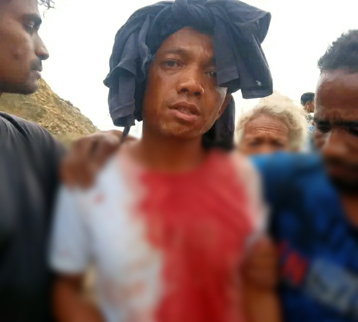 PNTL hahú investiga konfrontu Lourba no Carabau