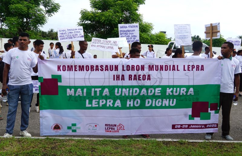 MLTL husu hakotu estigma sosiál hasoru pasiente lepra