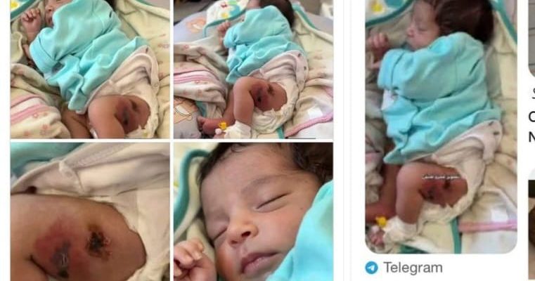 HNGV klarifika bebé vasina ho kelen kanek iha rede sosiál ne’e informsaun HOAX