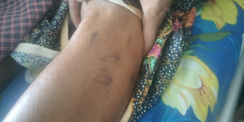 Sidadaun EX husi Gariuai suspeita kontaminadu raiva